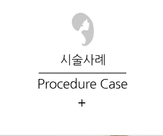 시술사례